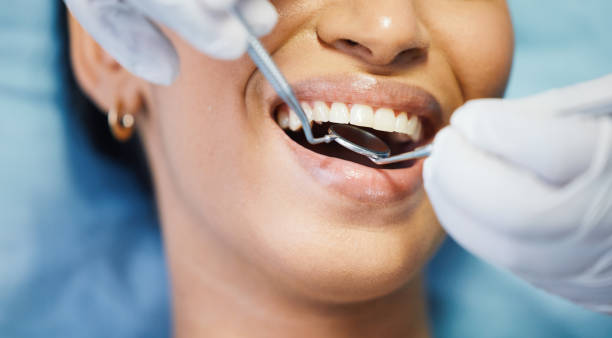 Best Emergency Treatment for Dental Infections or Abscesses in Lovell, WY