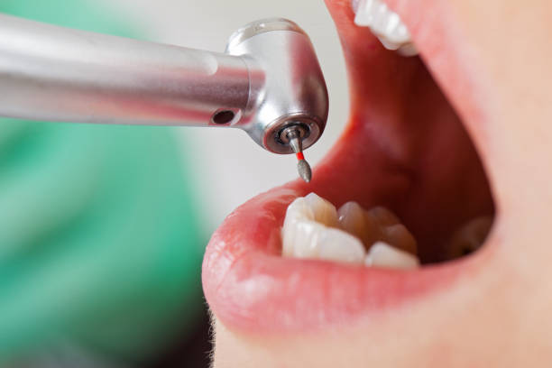 Best Emergency TMJ Treatment in Lovell, WY